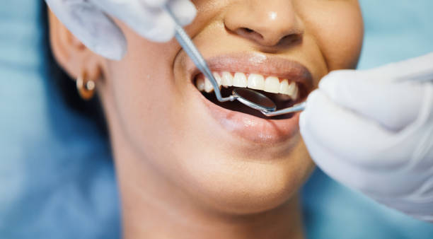 Best Emergency Treatment for Dental Infections or Abscesses in Trinidad, CO