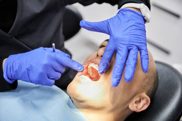 Best Emergency Tooth Extraction in Trinidad, CO
